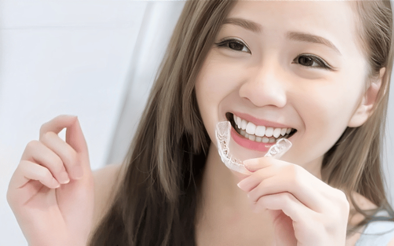 Lợi ích của việc niềng răng.