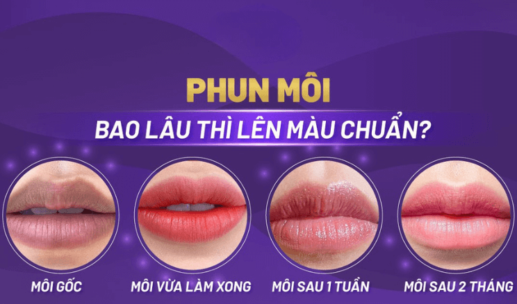 Xăm môi sau bao lâu thì lên màu? Quy trình và chăm sóc đúng cách