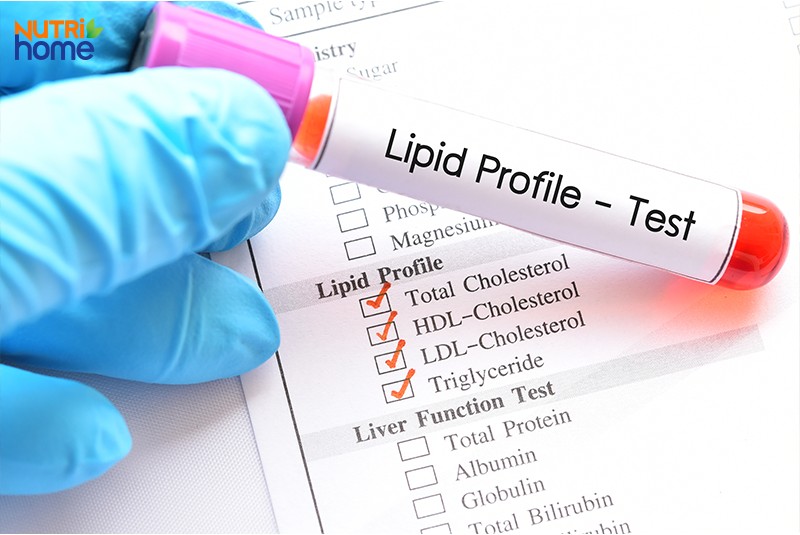 Lưu ý khi điều trị mỡ máu tại nhà, xét nghiệm mỡ máu định kỳ