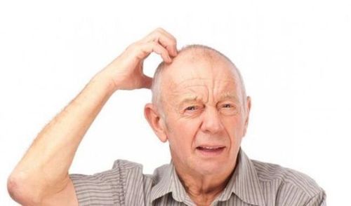  Dấu hiệu đột quỵ xuất hiện và biến mất rất nhanh 