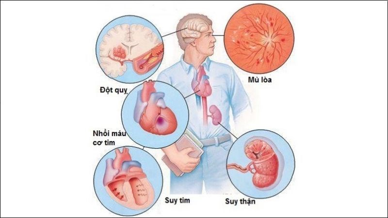 9 tác dụng phụ của thuốc huyết áp thường gặp bạn cần lưu ý